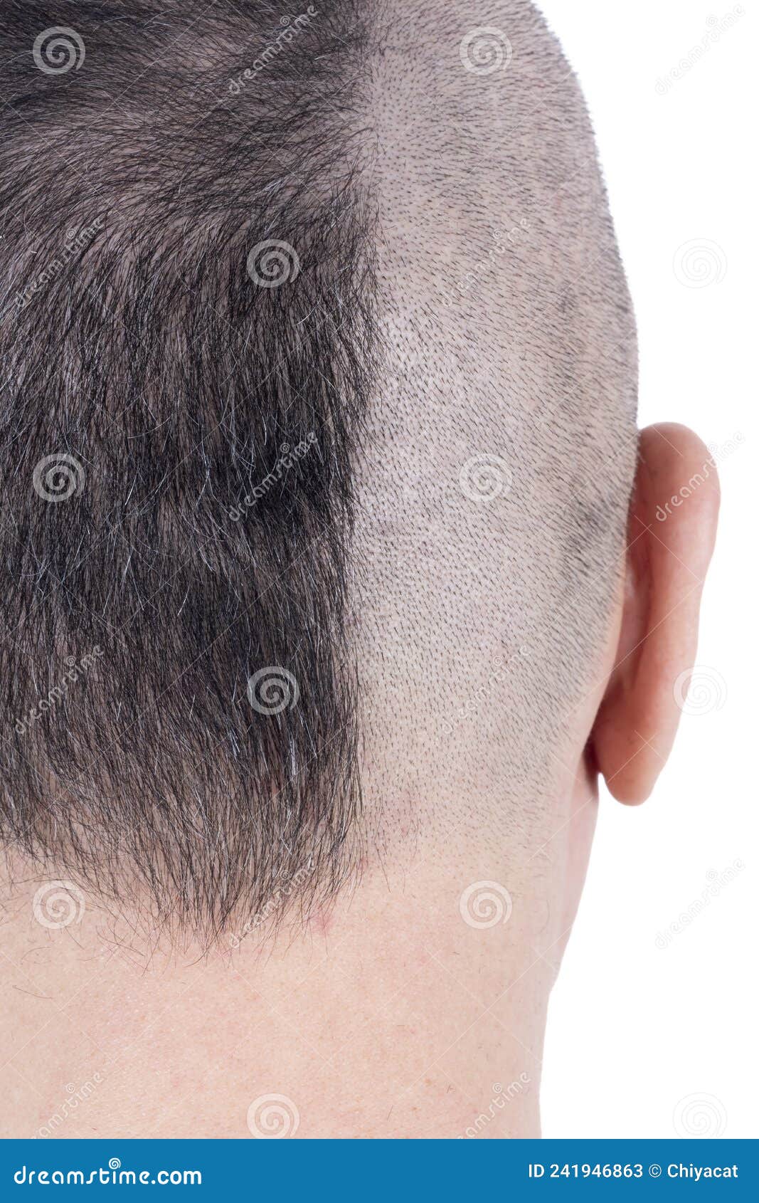 closeup of the back of a man`s head half shaven