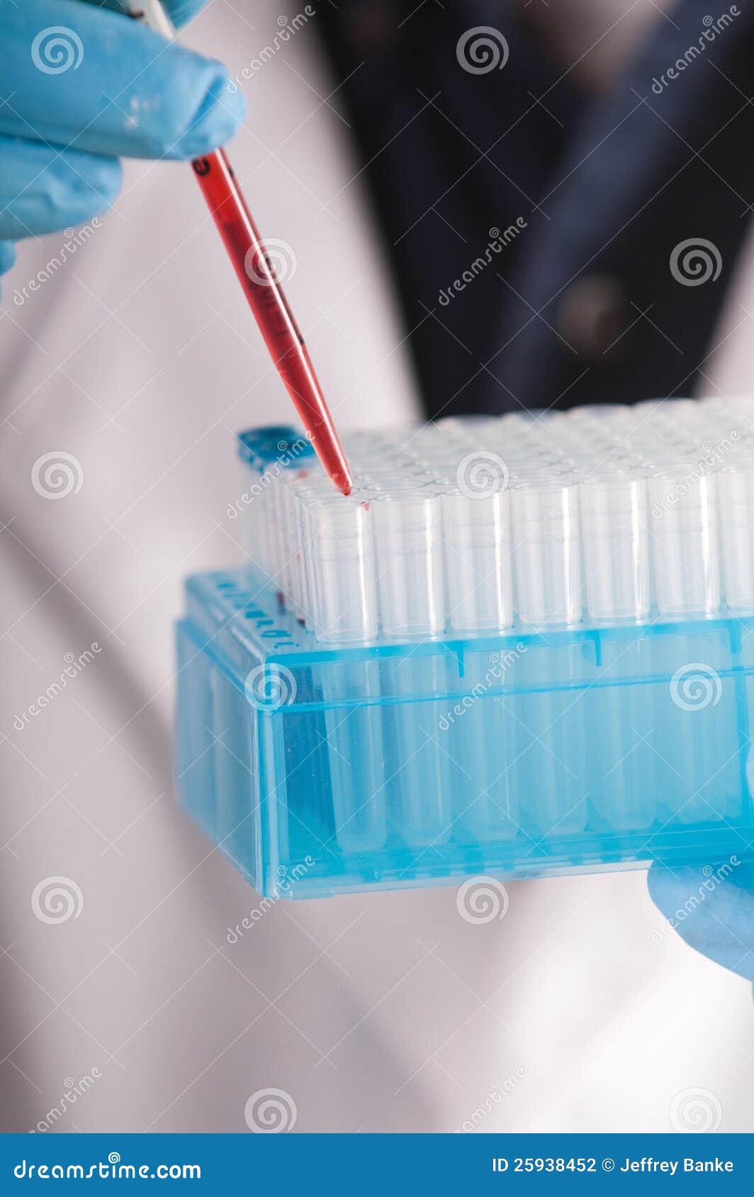 Closeup of Blood Sample for Analysis Stock Photo Image of growth