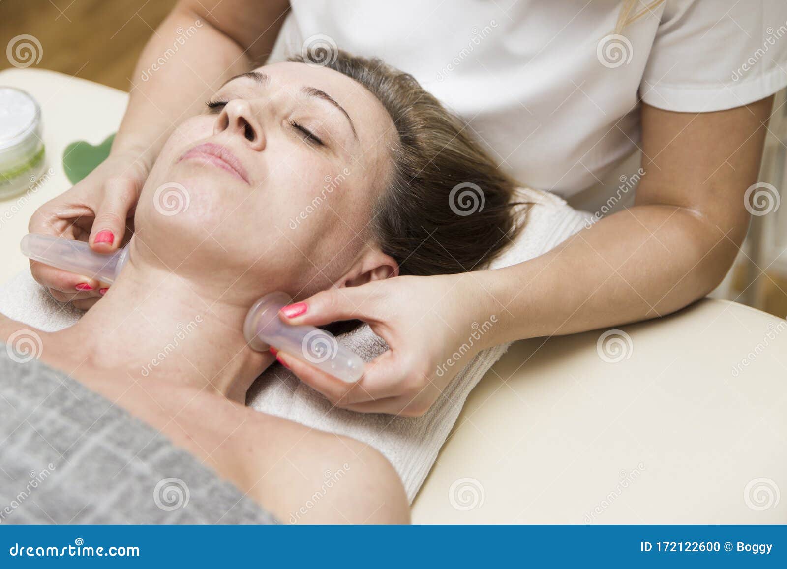 cup applied to neck skin of a female patient as part of the traditional method of cupping therapy