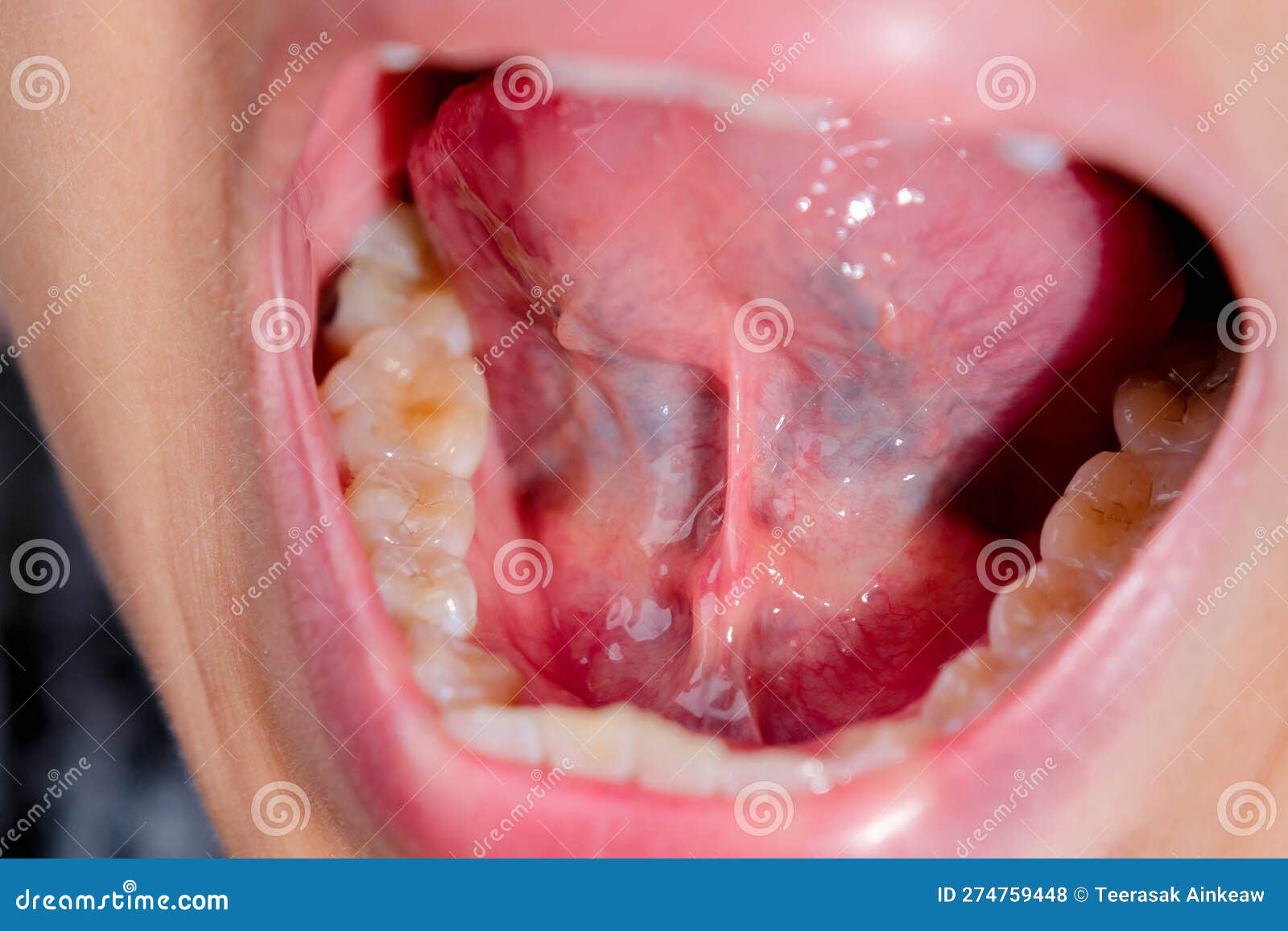 Miroir dentaire en gros plan dans la bouche.Macro photographie du processus  d'examen des dents Photo Stock - Alamy