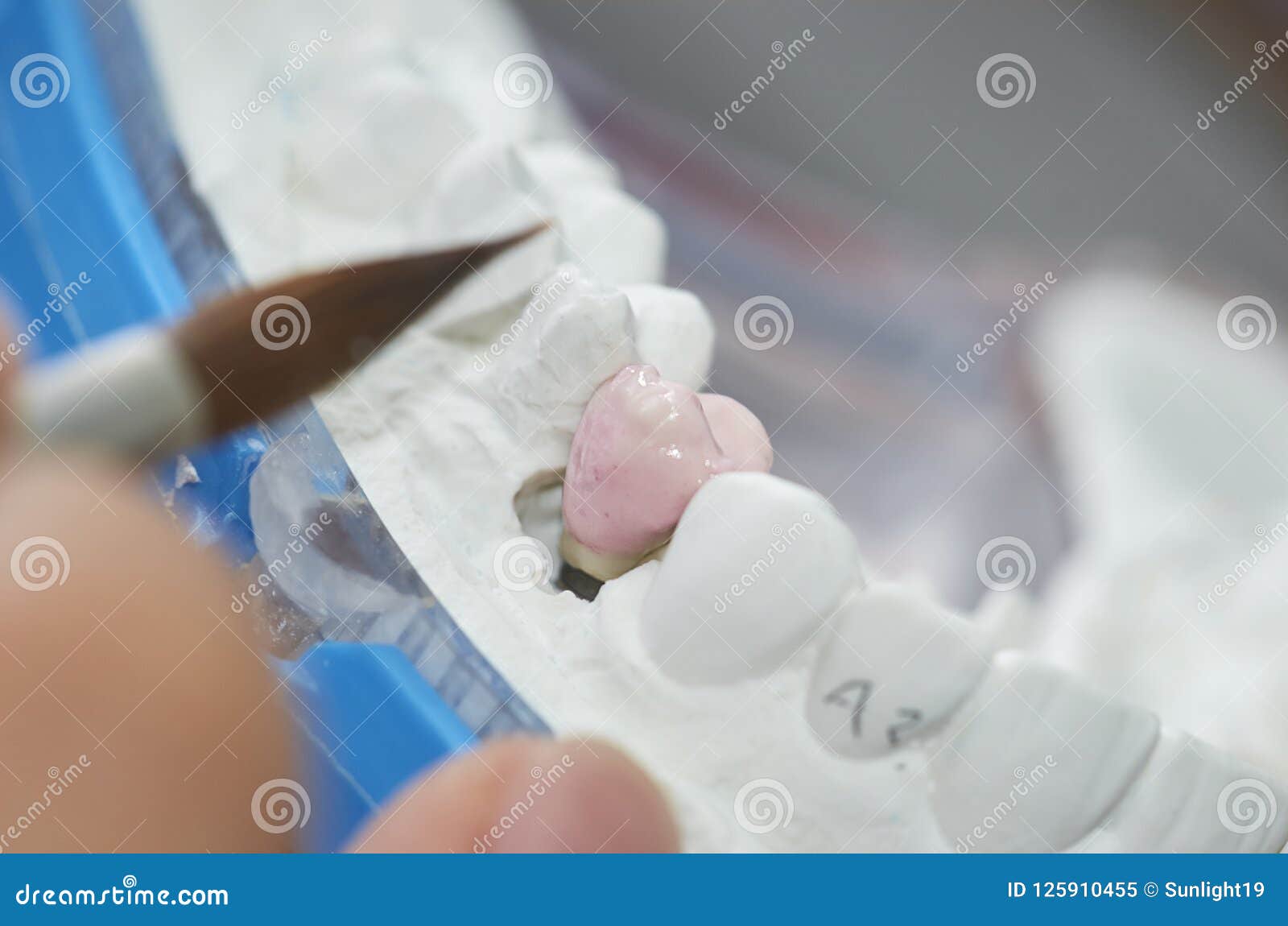 Closeup of Dental Technician Putting Ceramic To Dental Implants Stock