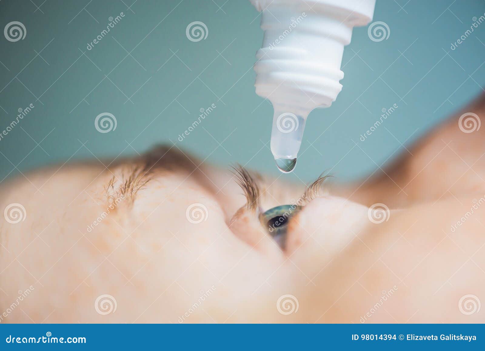 Closeup of Eyedropper Putting Liquid into Open Eye Stock Photo Image