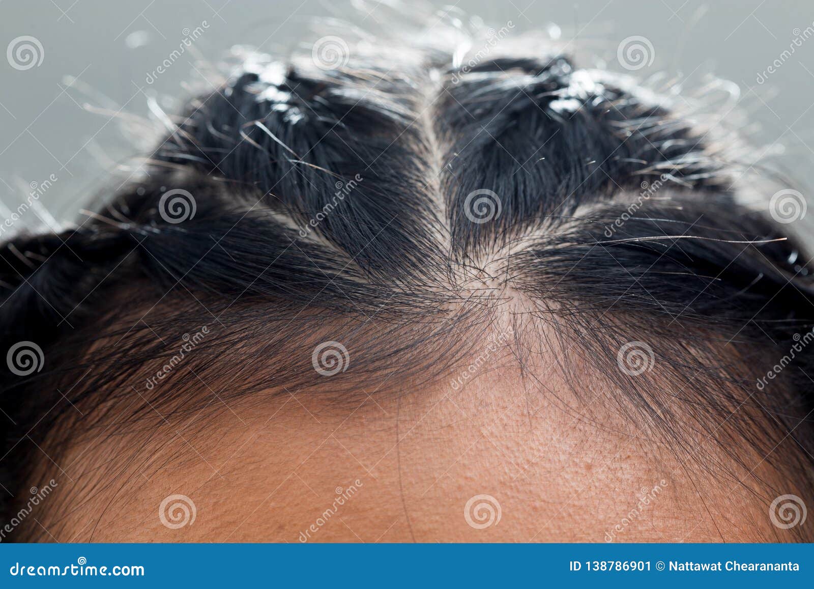 Body Part Hair Root Head Skin Close Up Woman Stock Image - Image of clean,  close: 138786901