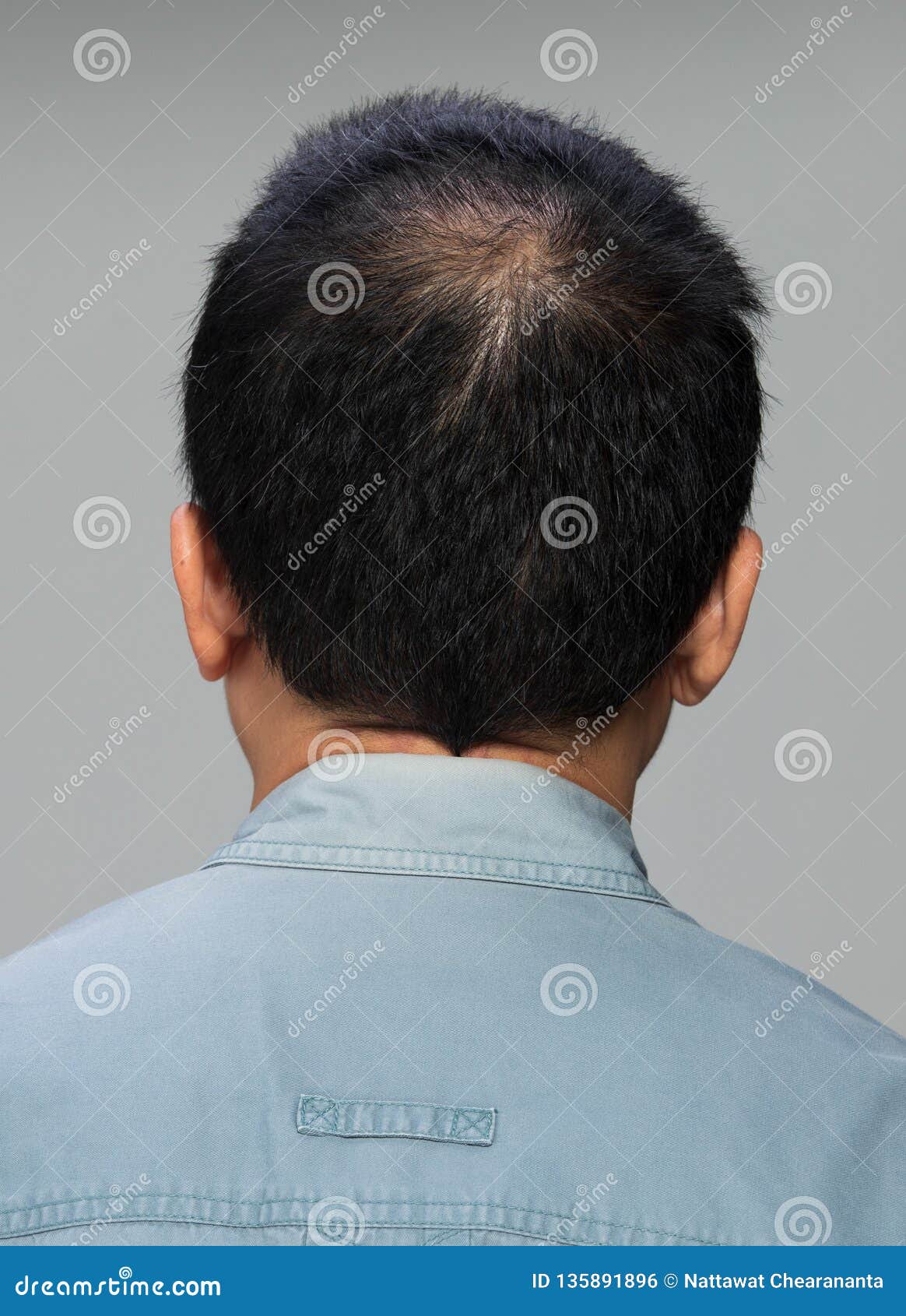 Back View of Male Hair Head Part Bald Stock Photo - Image of middle,  concept: 135891896