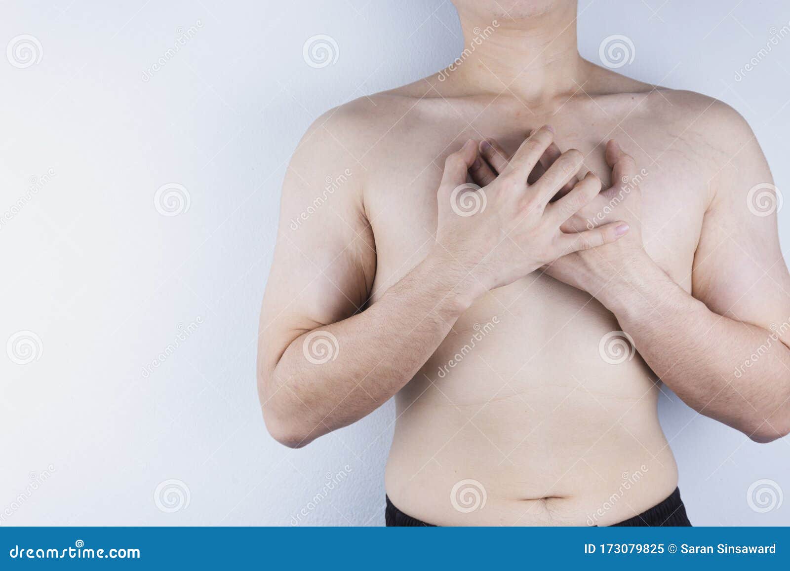 Молочной железы у мужчин симптомы. Разрастание молочных желез у мужчин фото.