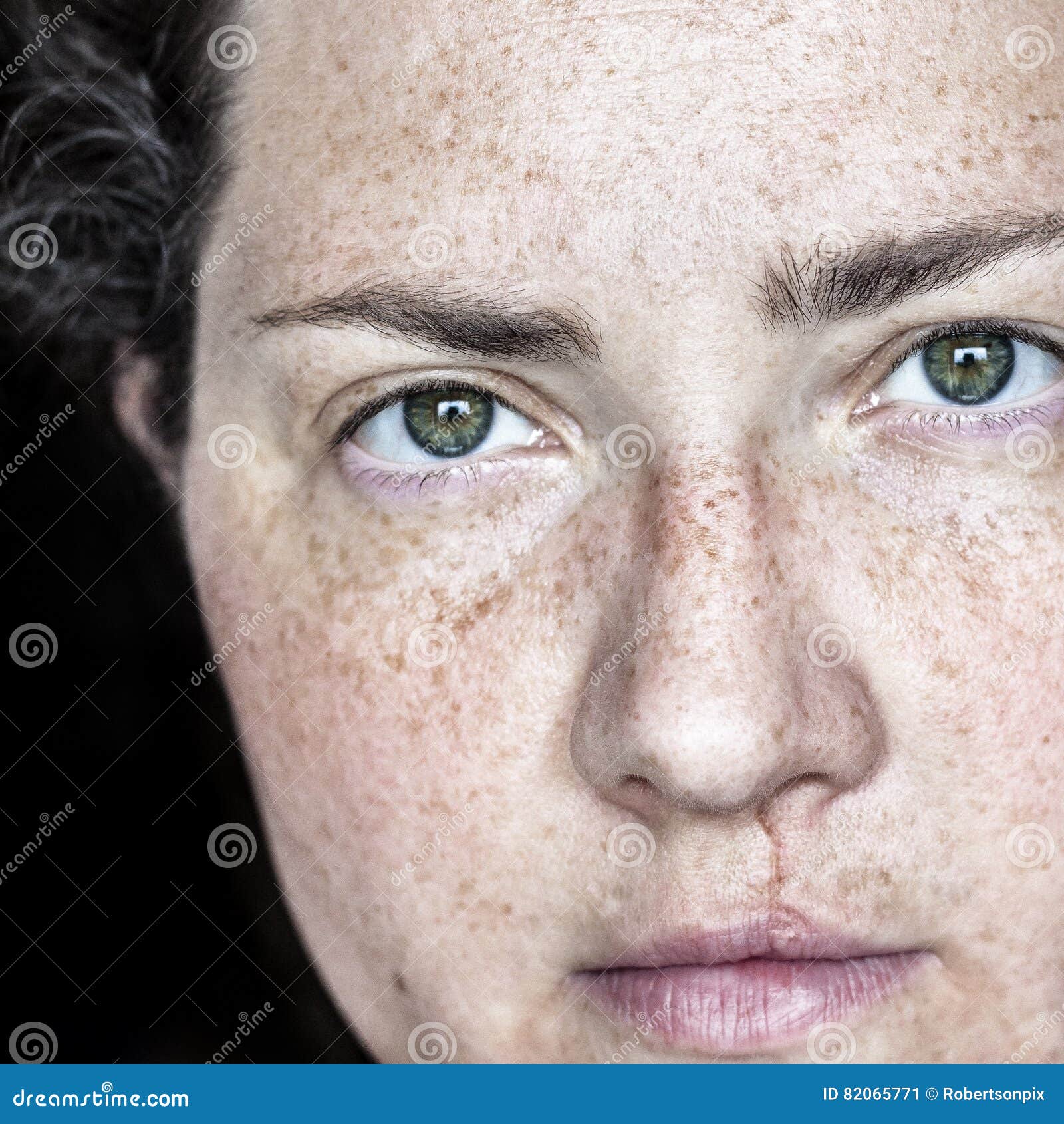 closeup portrait of caucasian woman with freckles and cleft lip looking directly at camera.