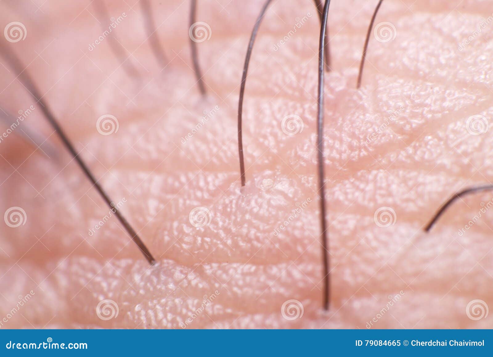 Closeup Skin with Finger Hair Stock Image Image of dermatology