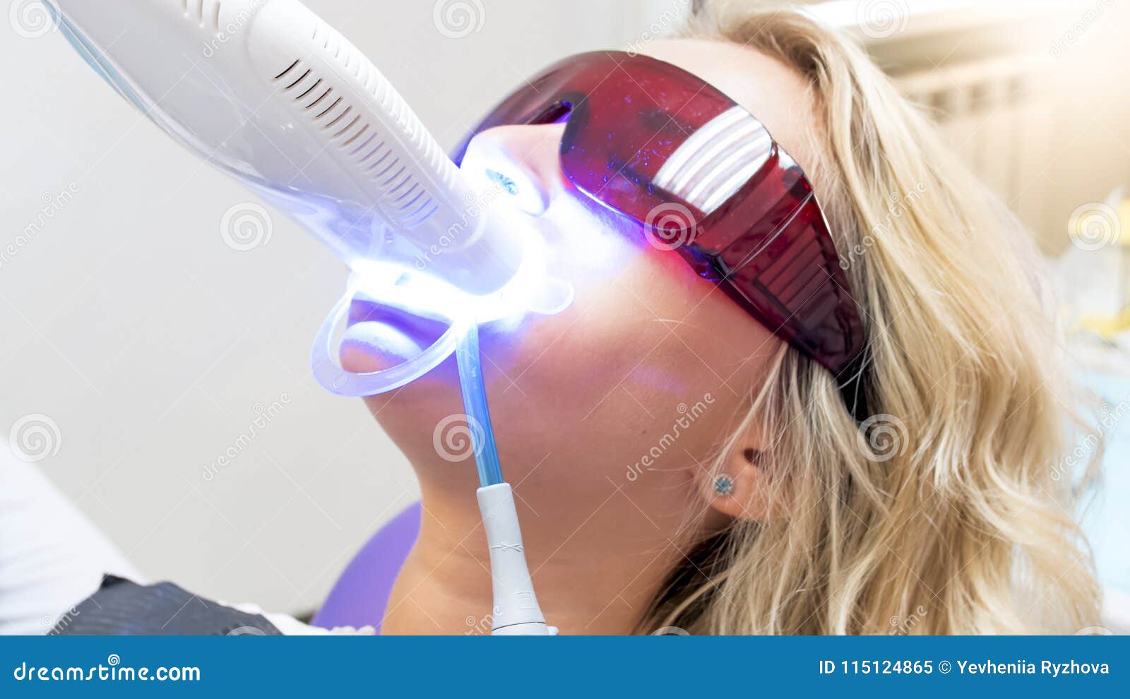Closeup Image of Teeth Whitening Procedure with UV Light Stock Image