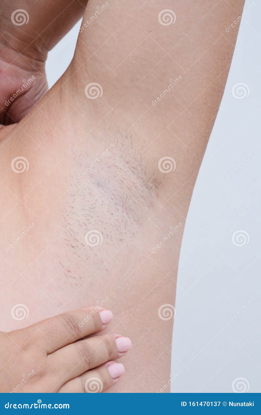 Skinny Girl With Hairy Armpits