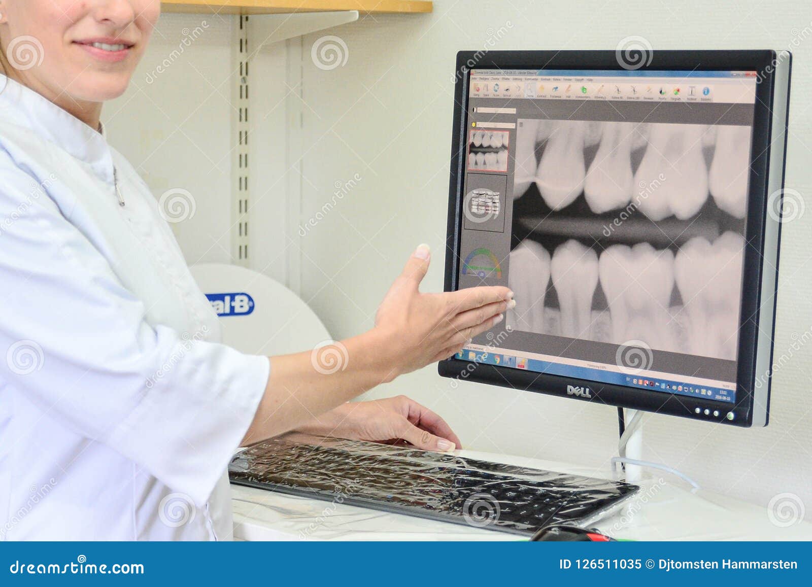 Closeups on Dentist`s Internship Editorial Image Image of caries