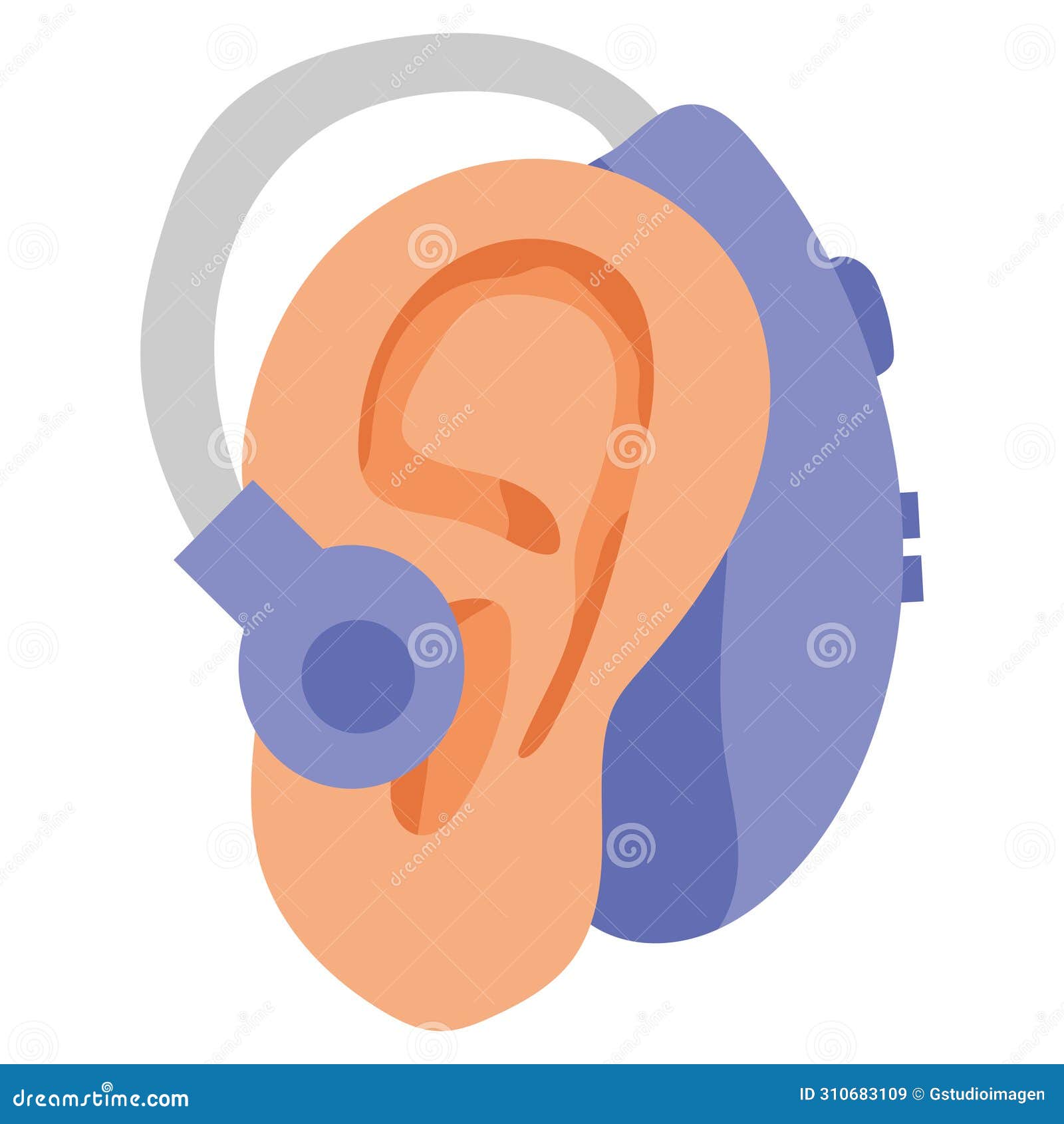 Cochlear Implant In Ear Vector Illustration 310683109