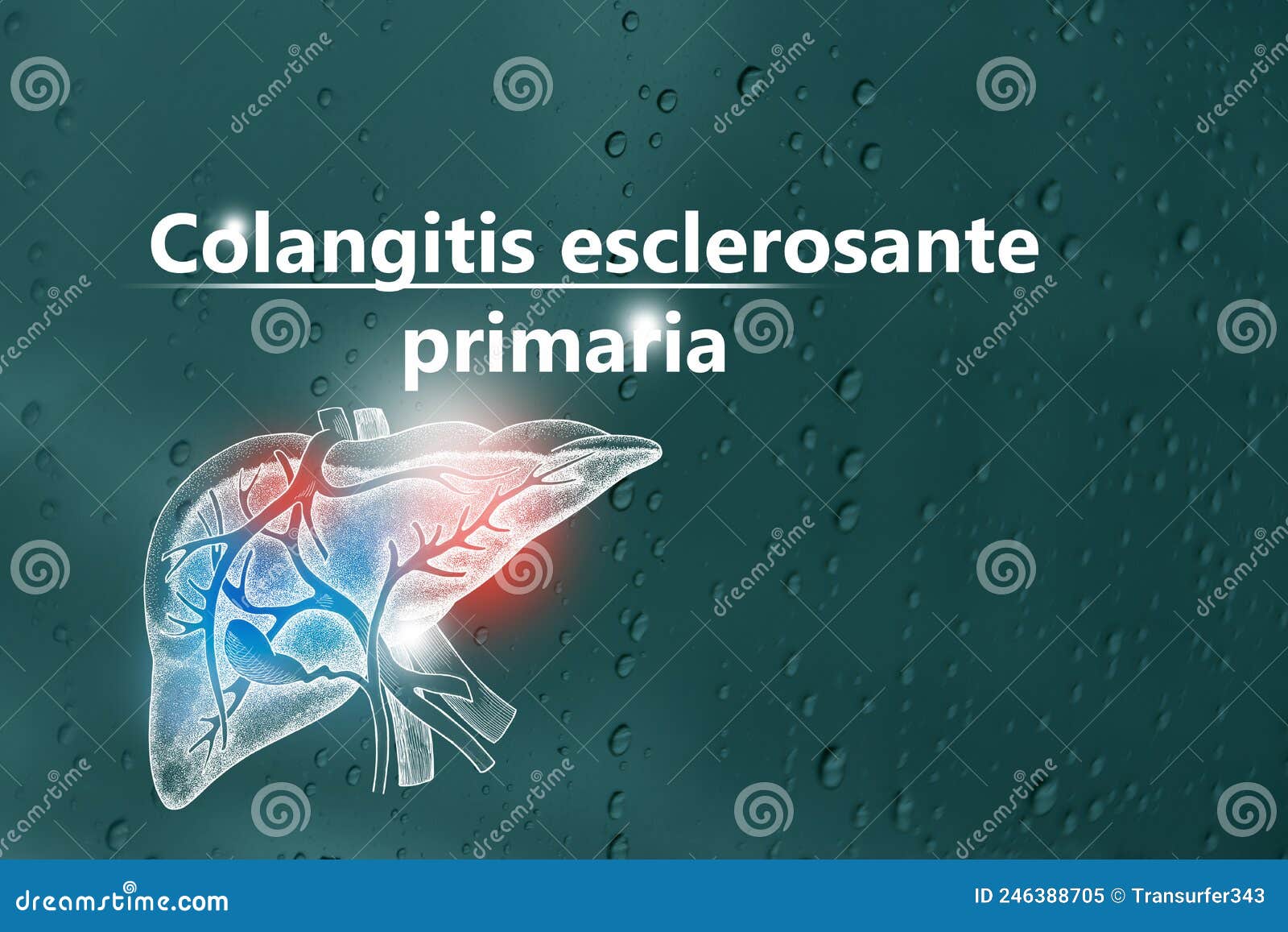colangitis esclerosante primaria - diagnÃÂ³stico y tratamiento, lista de comprobaciÃÂ³n mÃÂ©dica. fondo texturizado y espacio de