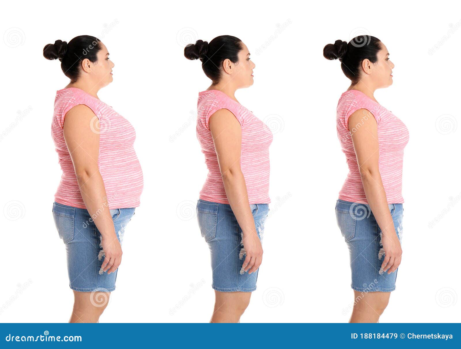 Collage with Photos of Overweight Woman before and after Weight Loss on ...