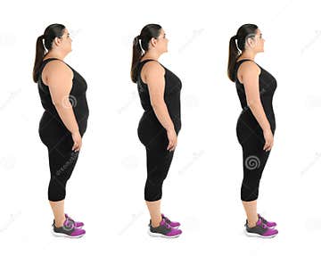 Collage with Photos of Overweight Woman before and after Weight Loss on ...