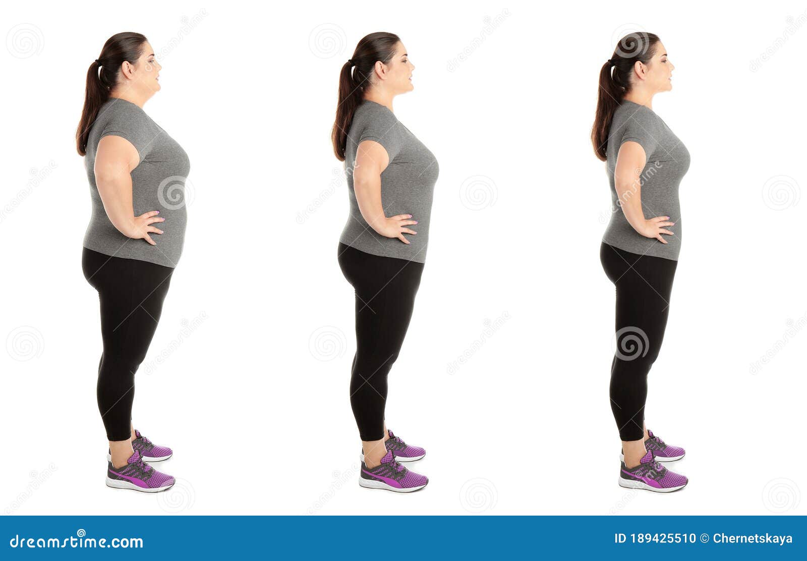 Collage with Photos of Overweight Woman before and after Weight Loss on ...