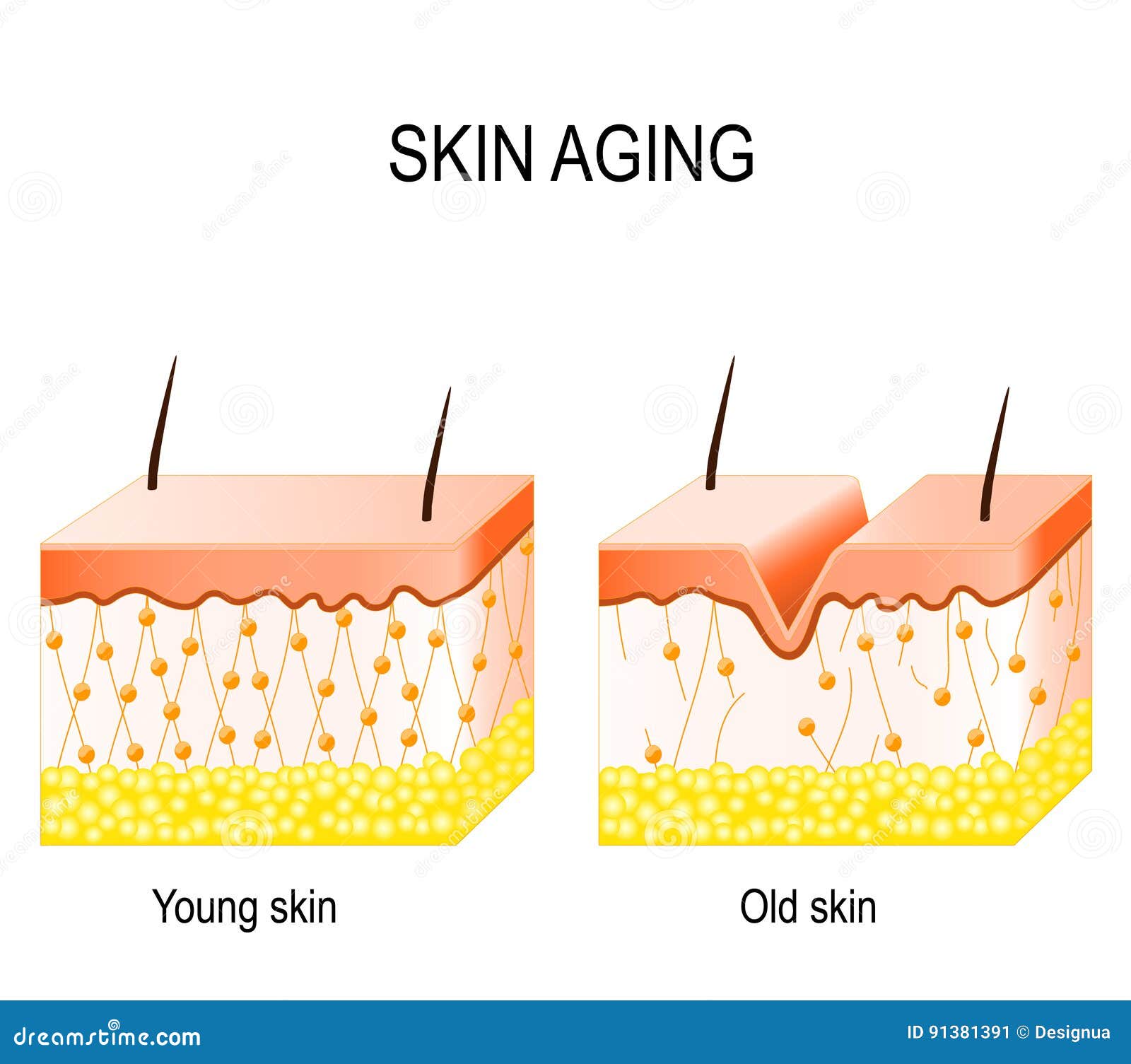 collagen in younger and older skin. collagen in younger and older skin.