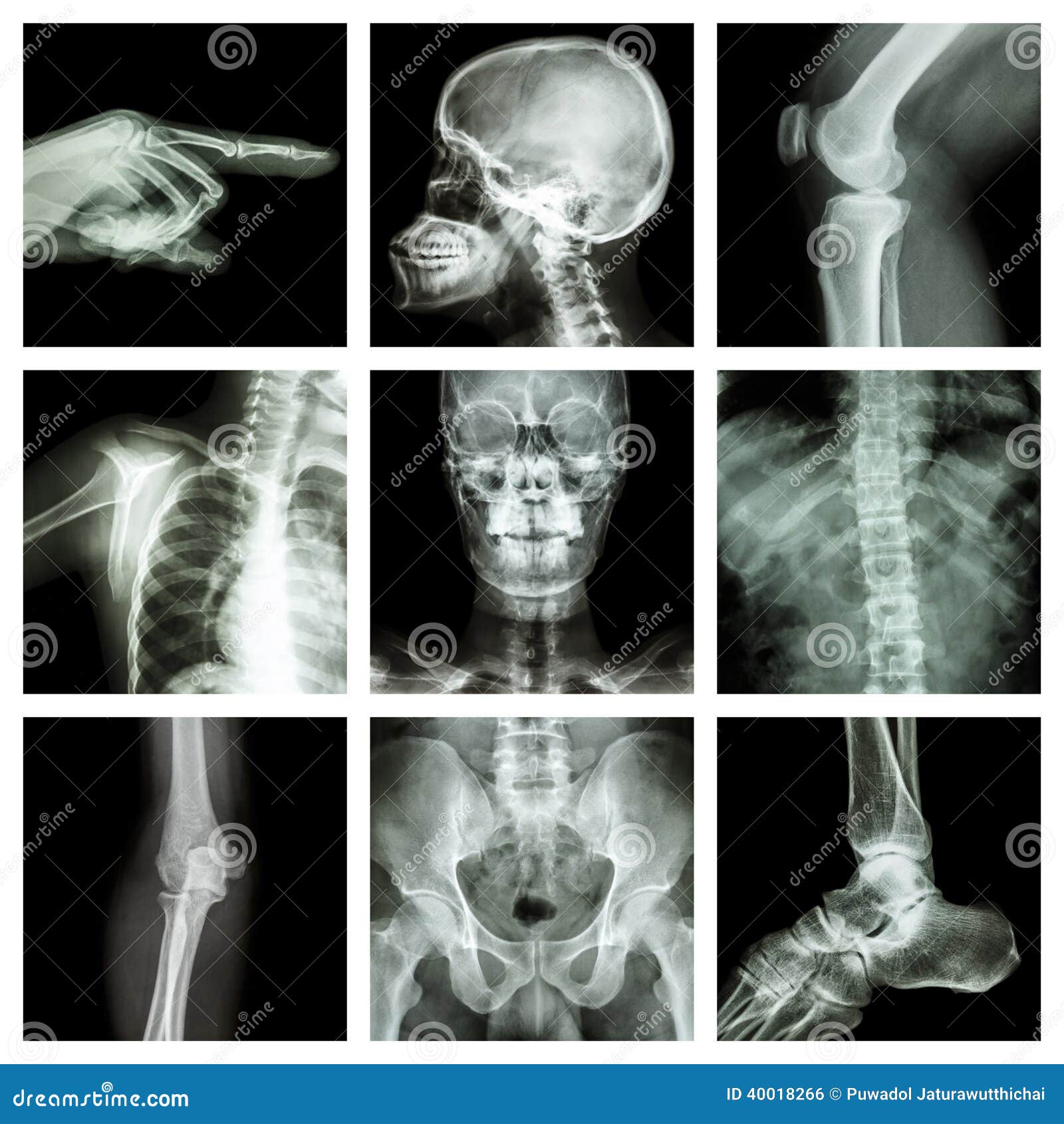 Collection Xray Part of Human (Version 2) Stock Photo Image of hospital, collection 40018266