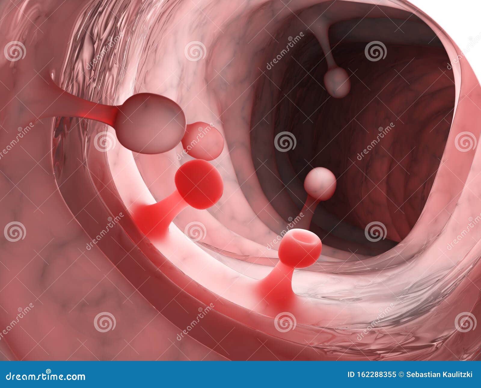 Precancerous Cartoons Illustrations Vector Stock Images 114 precancerous-cartoons-illustrations-vector-stock-images-114