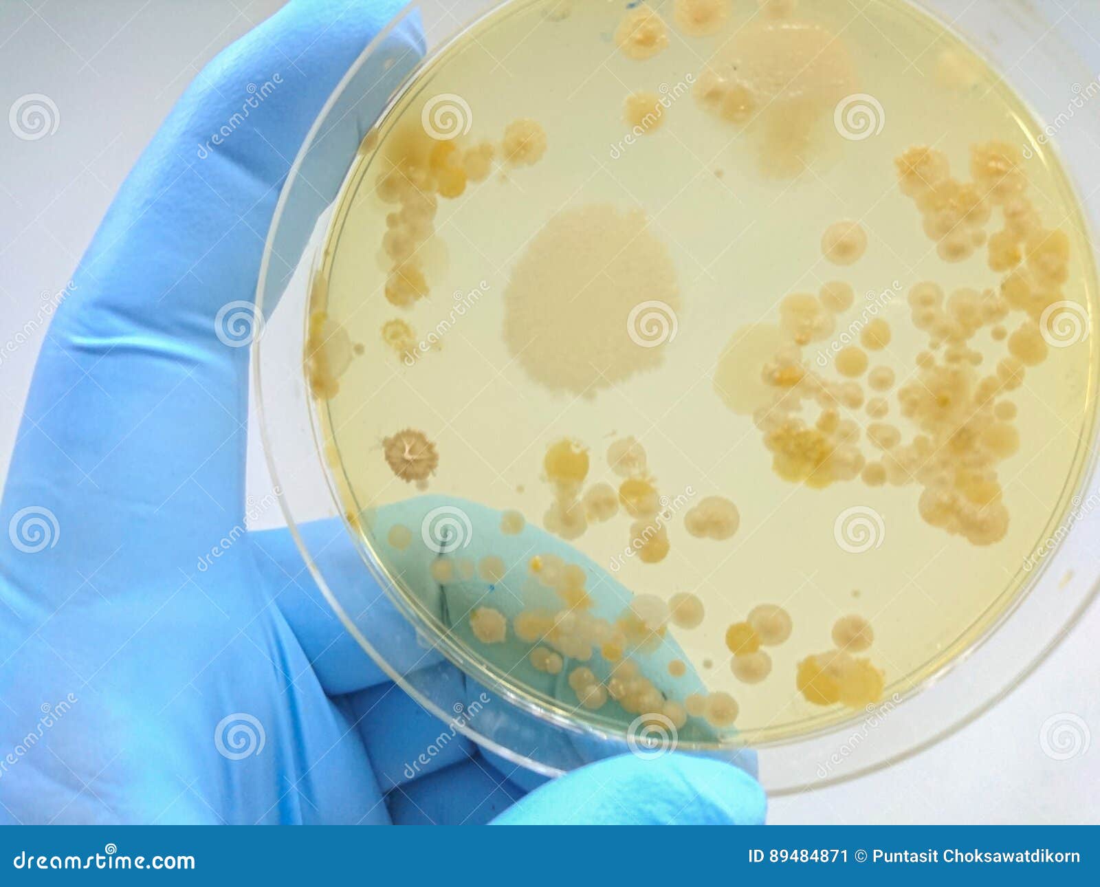 Colony of Bacteria in Culture Medium Plate Stock Image Image of