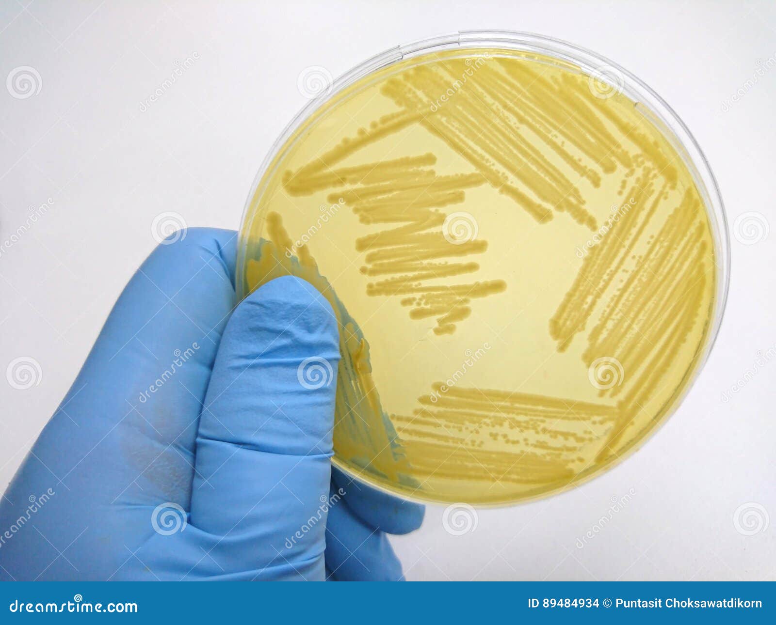 Colony of Bacteria in Culture Medium Plate Stock Photo Image of