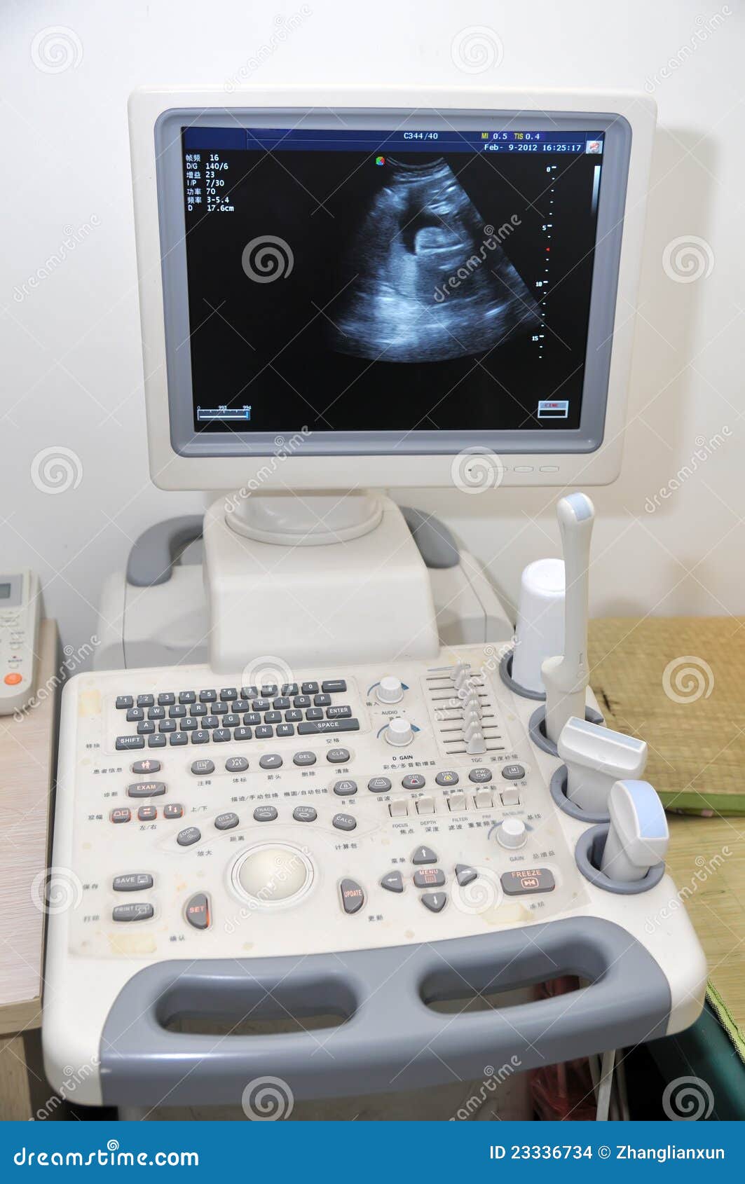 color doppler ultrasound