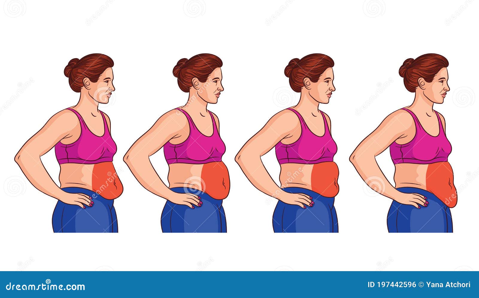 four types of belly in women.