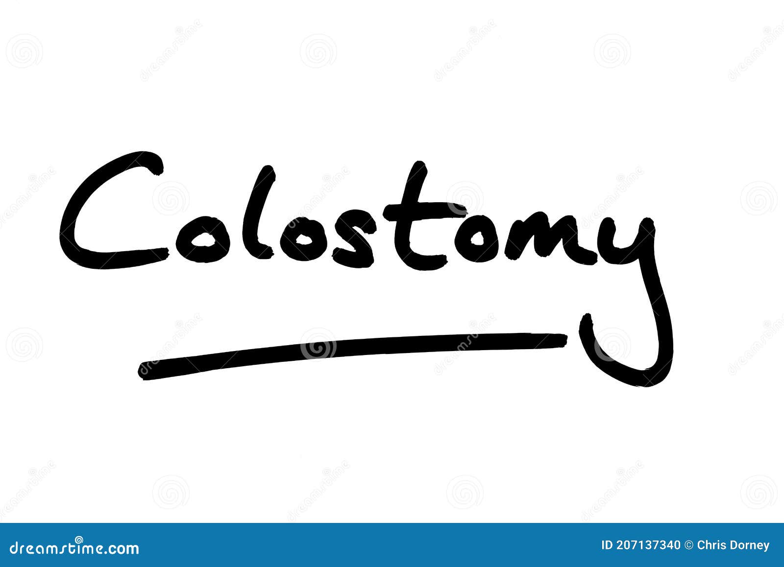 Colostomy stock illustration. Illustration of surgery 207137340