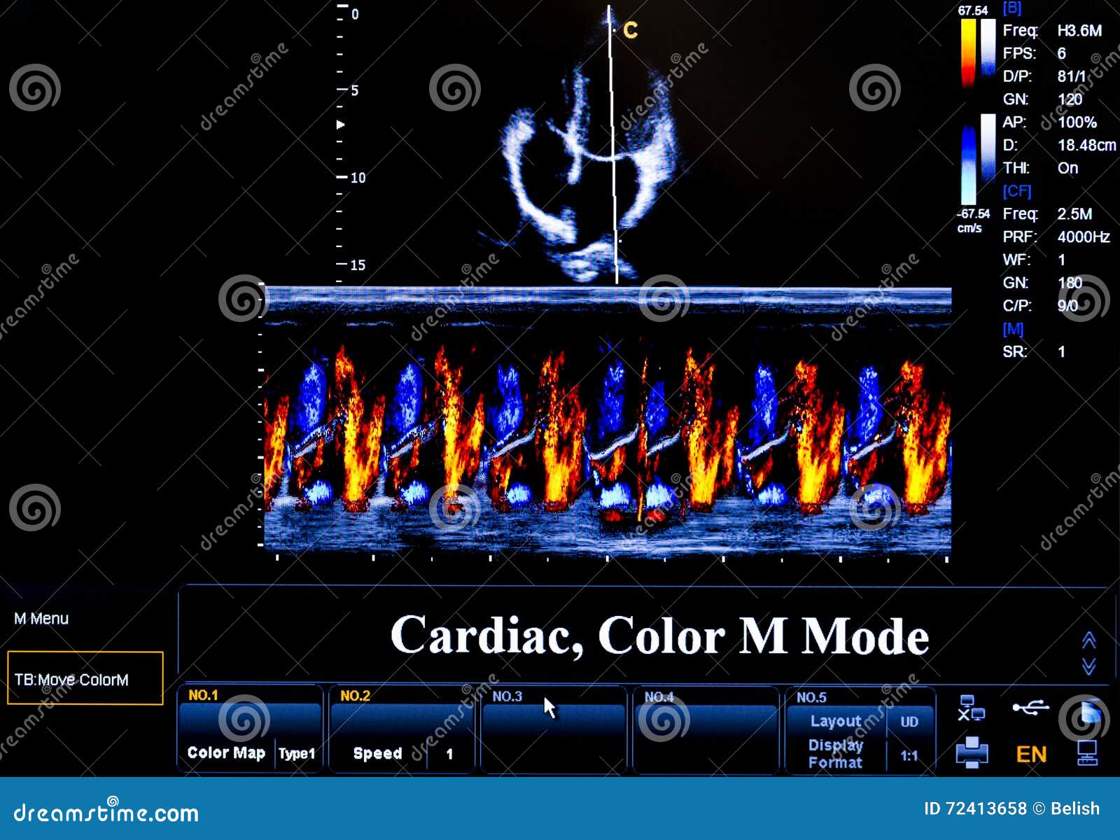 Modern Echocardiography (ultrasound) Machine Monitor. Colour Ima