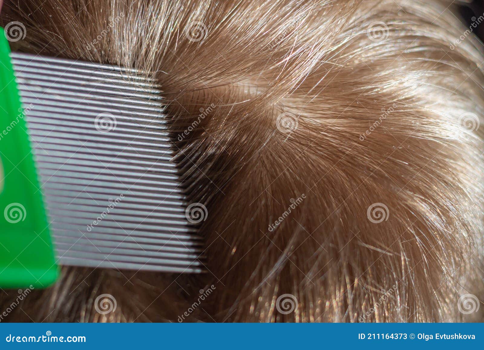 Comb Out Lice from the Hair with a Special Comb with Frequent Teeth Stock  Image - Image of infection, groom: 211164373