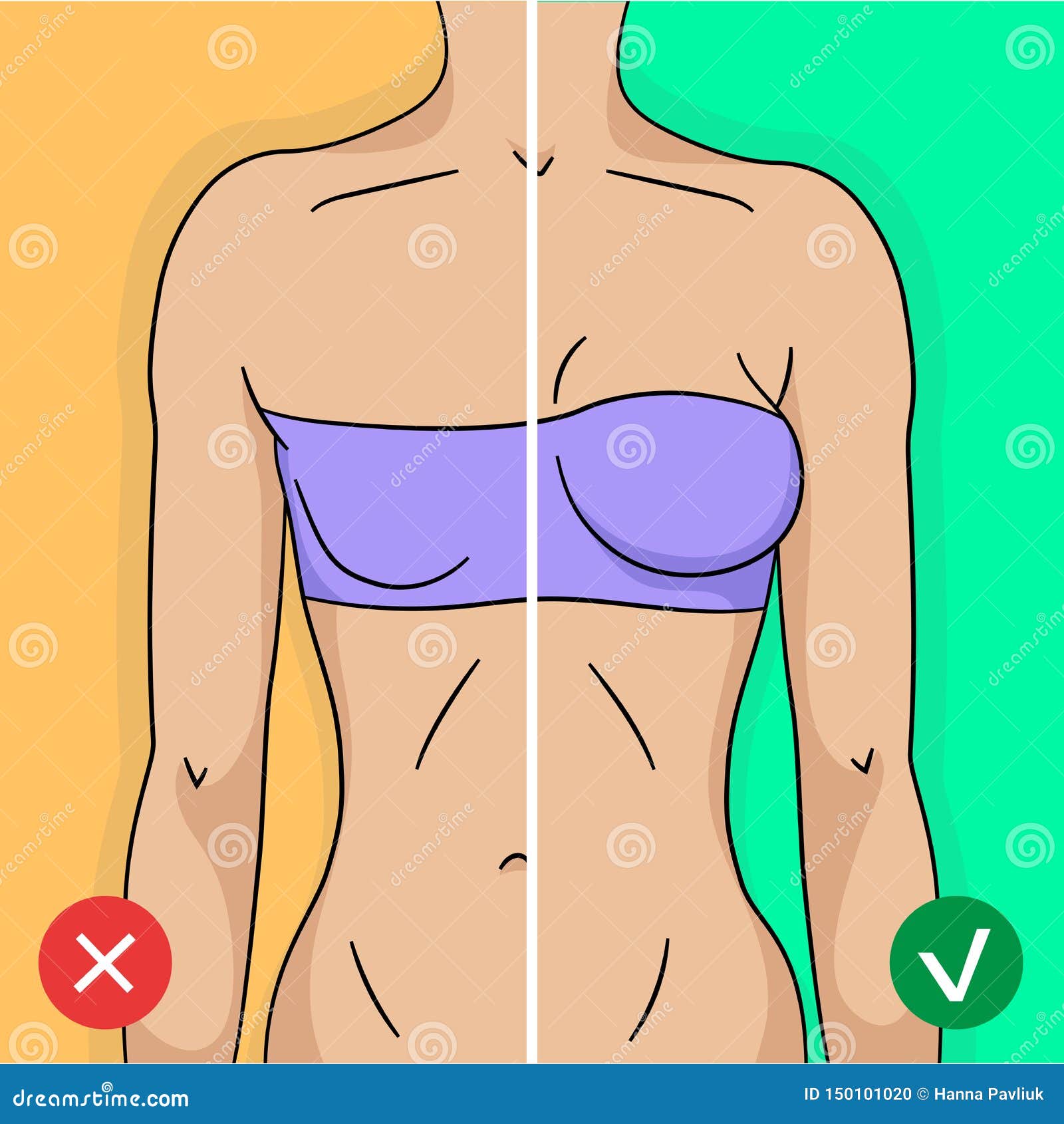 https://thumbs.dreamstime.com/z/comparison-woman-breast-training-surgery-simple-modern-flat-style-150101020.jpg