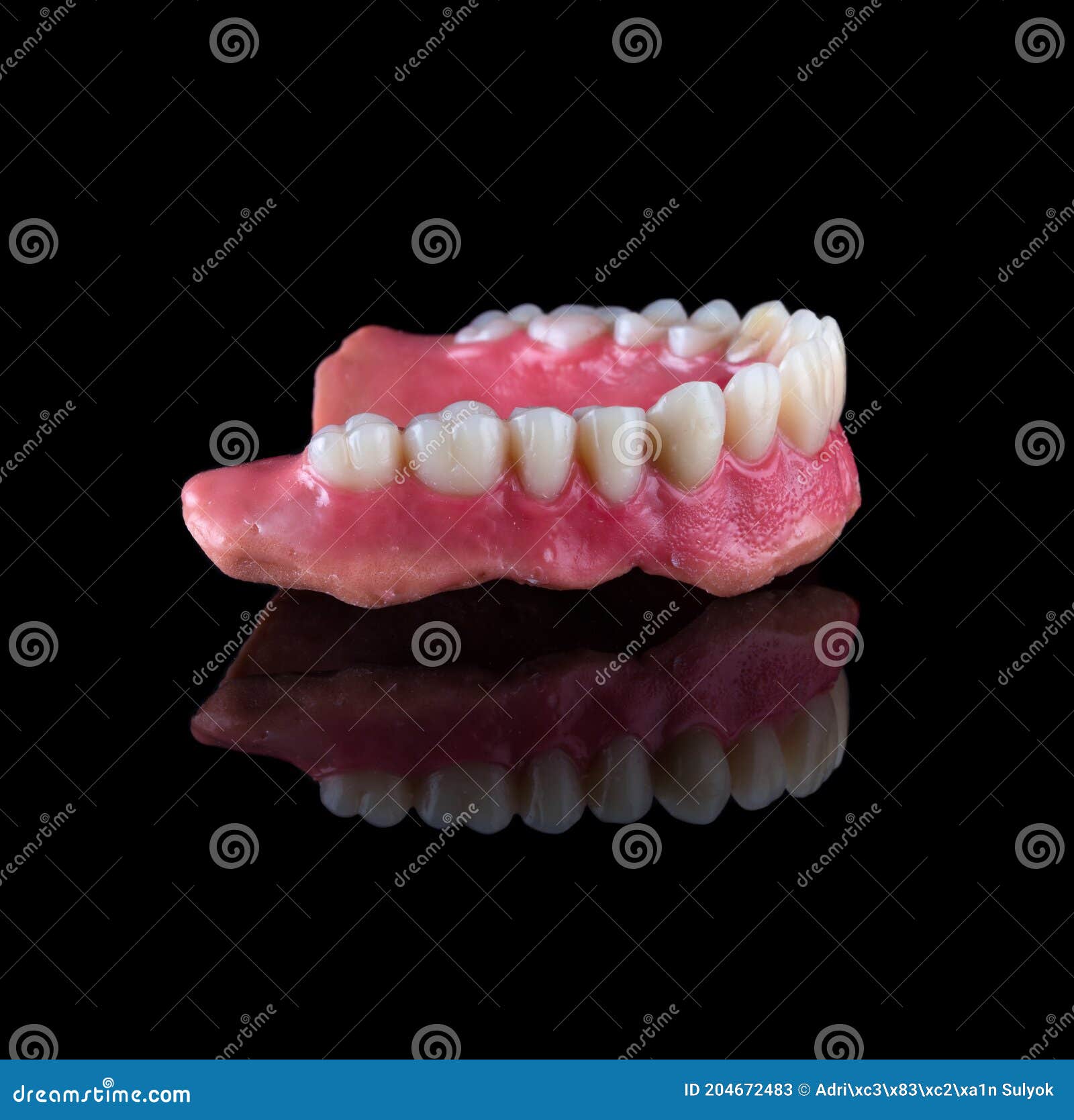 Complete Maxillary Denture â€“ WaxUp and Gingival Contouring Stock