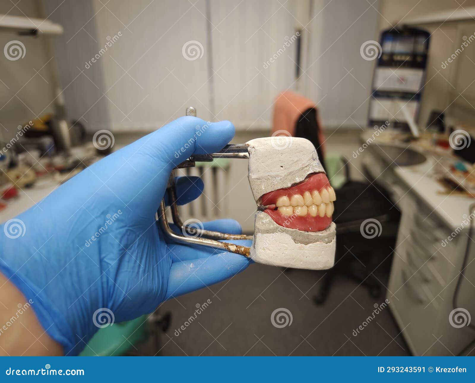 Complete Removable Dental Prostheses on Gypsum Models Stock Image