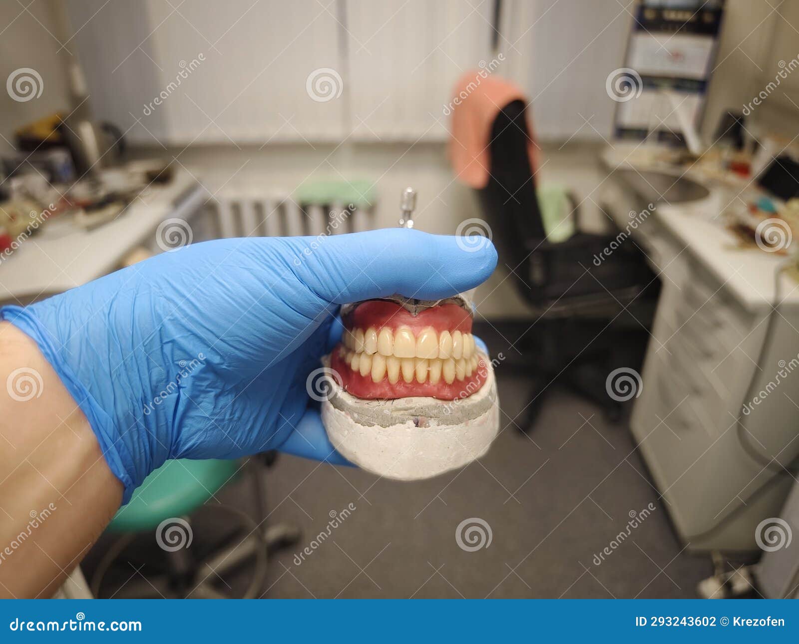 Complete Removable Dental Prostheses on Gypsum Models Stock Photo