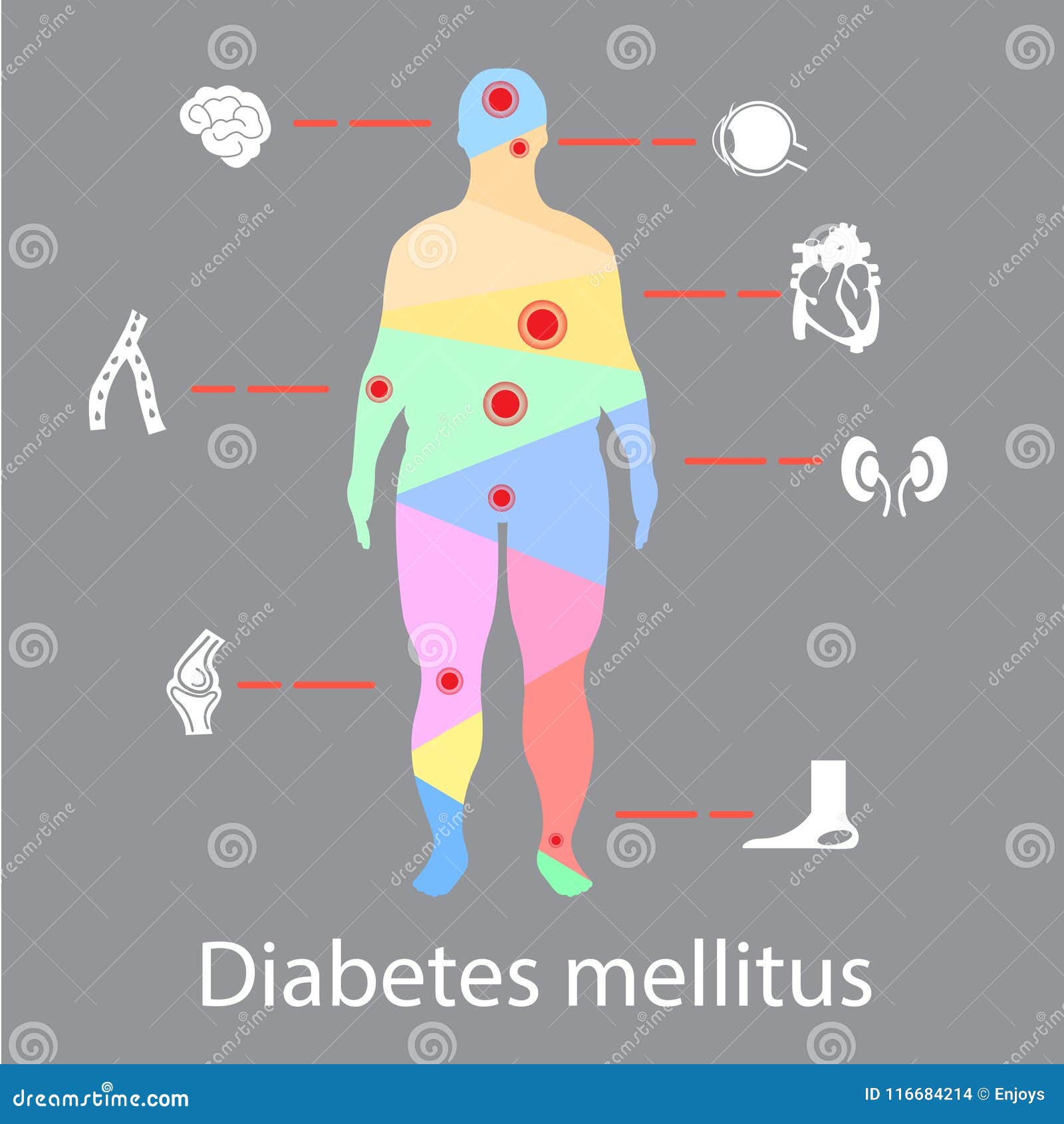 Complications of Diabetes Mellitus in Fat People. Illustration in  Infographic Style about Medical and Health Stock Vector - Illustration of  brain, anatomy: 116684214