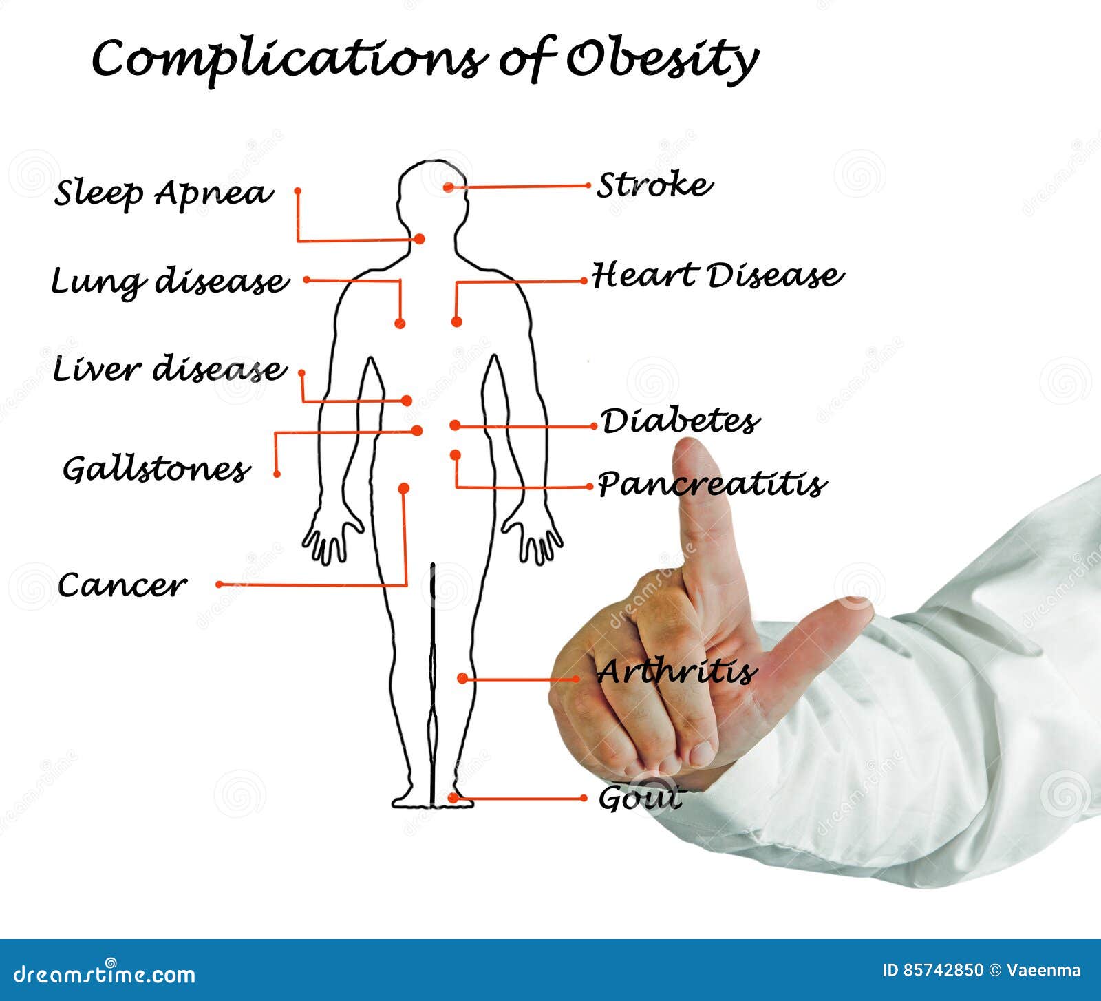 complications of obesity