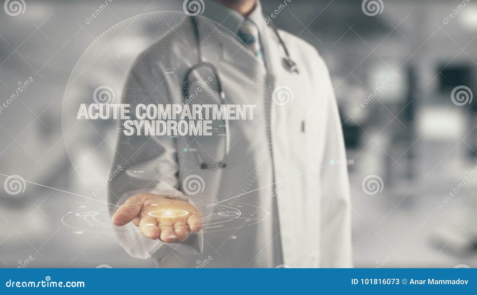 Doctor Holding in Hand Acute Compartment Syndrome Stock Image Image