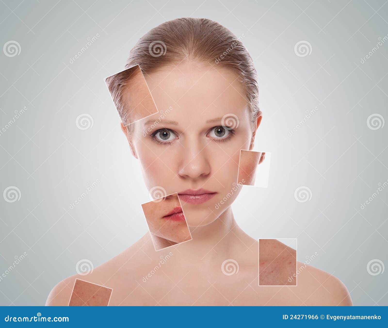 Concept of Cosmetic Effects, Treatment, Skin Care Stock Photo Image