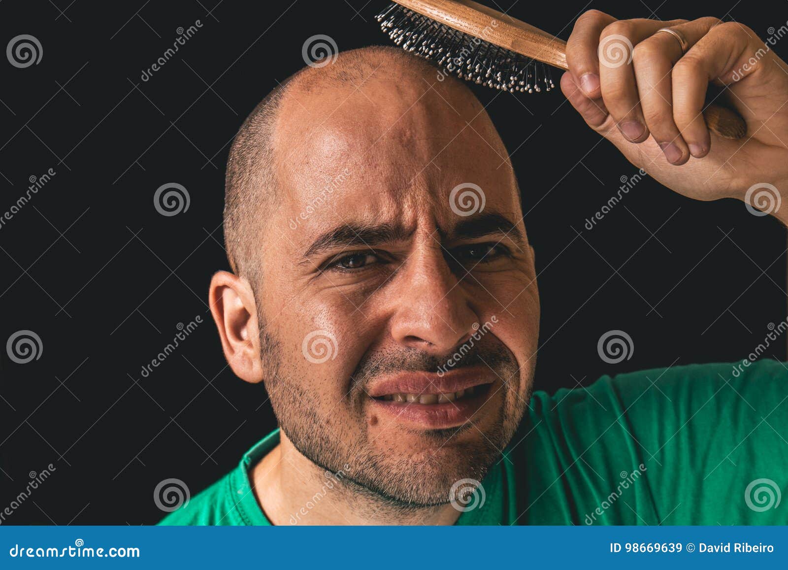 Concept De Perte Des Cheveux Homme Chauve Employant La Brosse De Cheveux  Sur Les Cheveux Inexistants Image stock - Image du accroissement, coiffure:  98669639