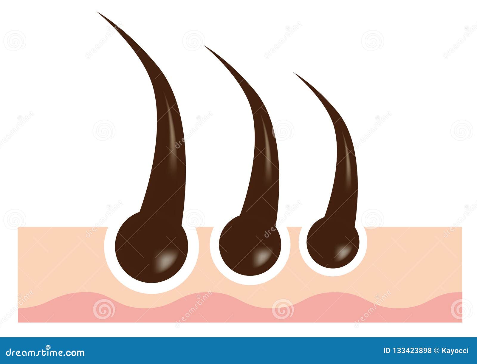 Vector Image Material of Hair Follicle Stock Vector - Illustration of care,  dermis: 133423898