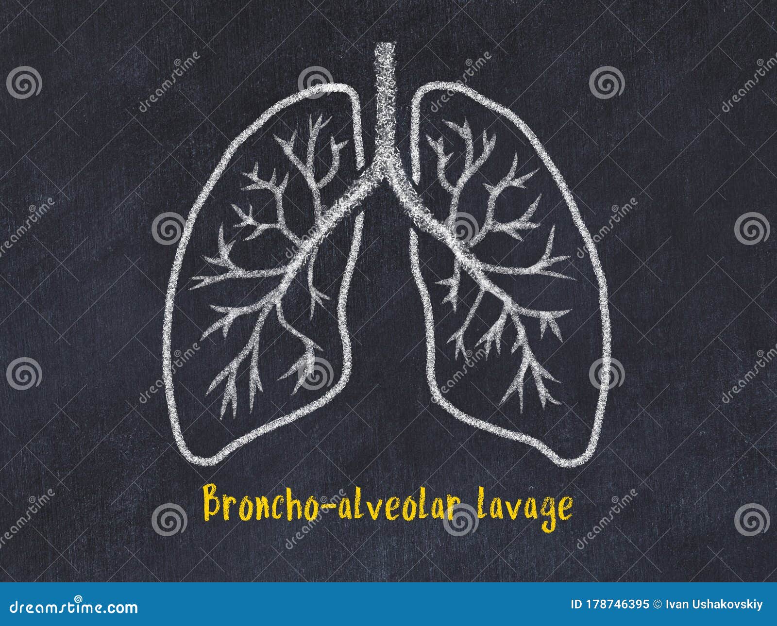 concept of learning lung diseases. chalk drawing of lungs with inscription