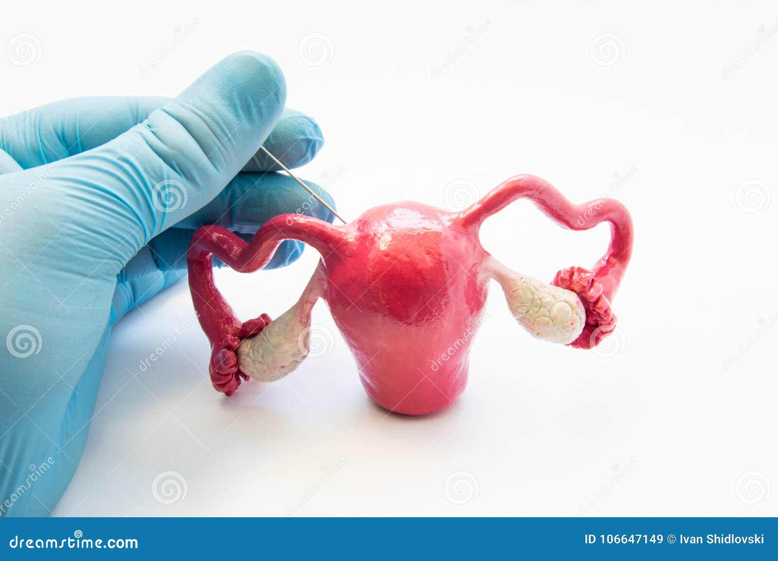concept photo of gynecological surgical procedure of biopsy female reproductive organs and tissues - uterine, endometrium or ovari