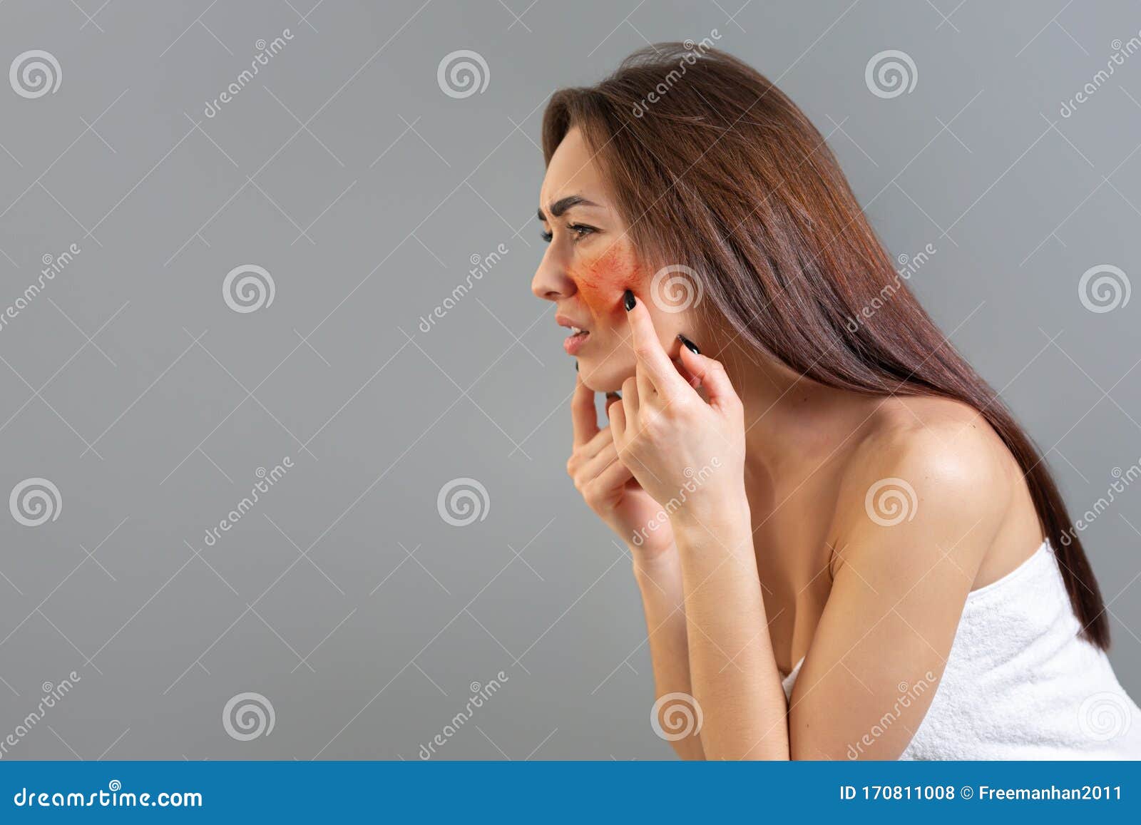 the concept of rosacea. a young caucasian woman pokes her rosacea-red cheek in frustration. copy space. gray background. side view
