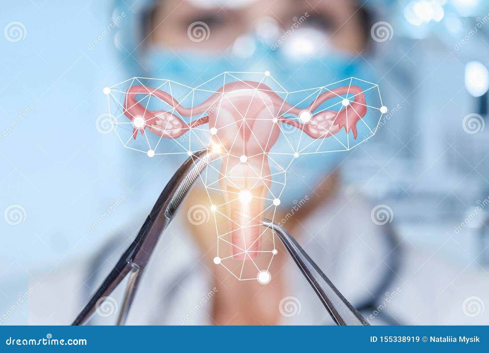 The Concept of Surgical Treatment of the Uterus Stock Image Image of