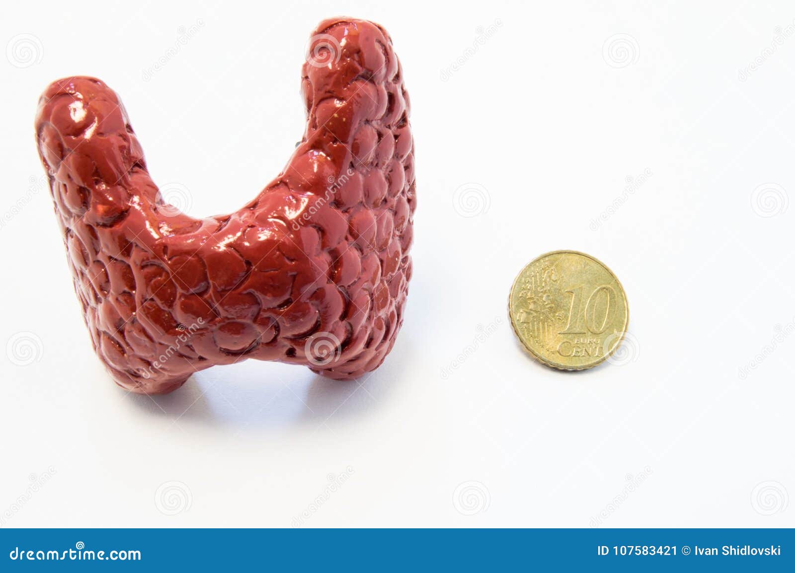 concept of visualization of enlarged thyroid gland in various diseases, such as goiter, thyroiditis, nodule. anatomical model of t