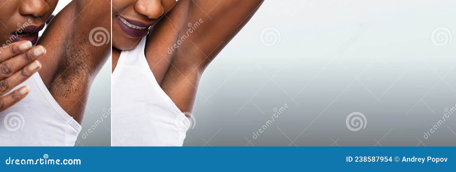 before and after concept of woman's underarm hair removal
