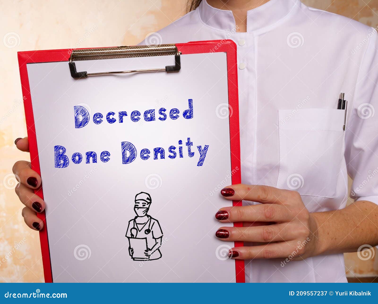 Conceptual Photo about Decreased Bone Density with Handwritten Phrase Stock Image Image of