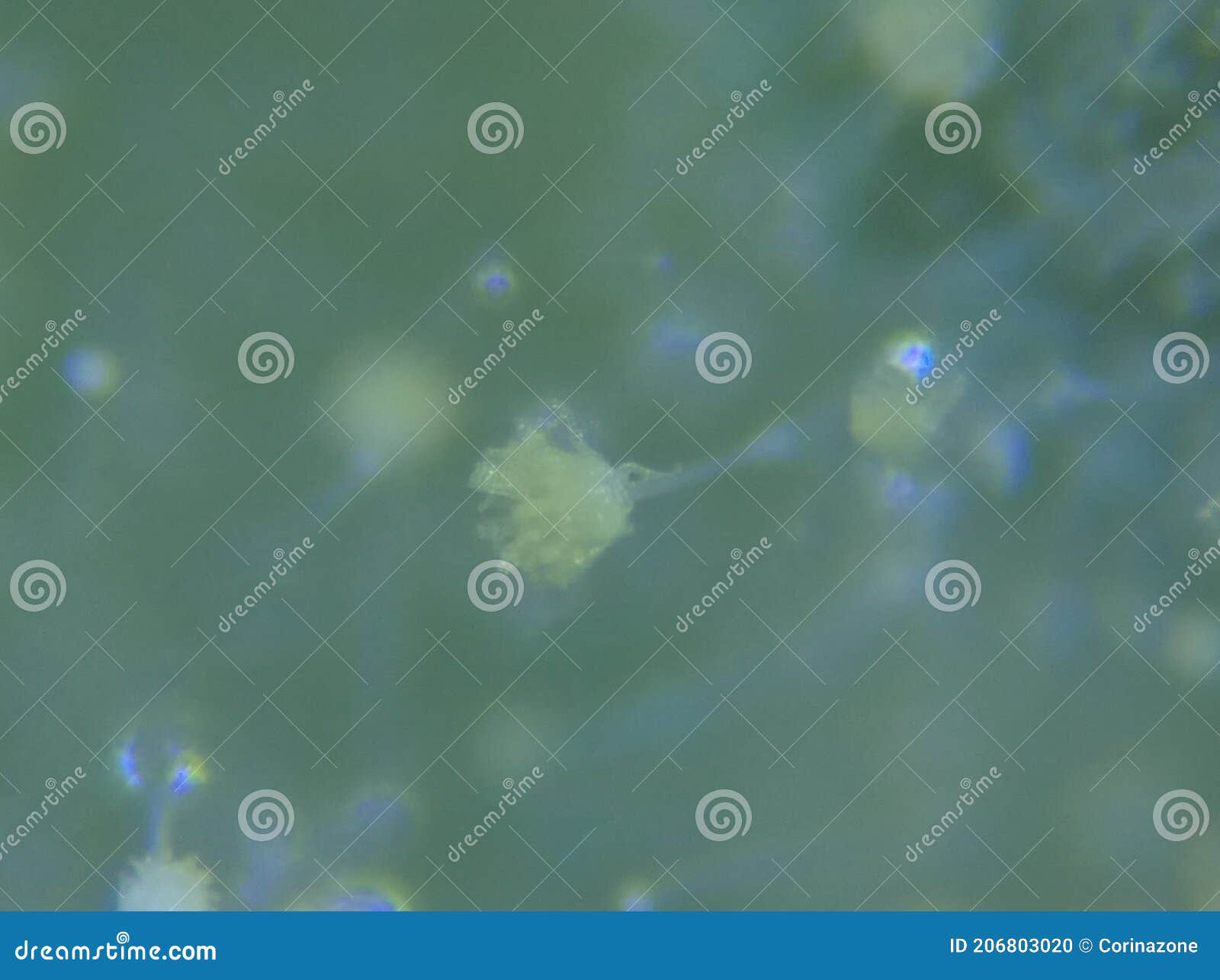 aspergillus flavus mold conidia under the microscope