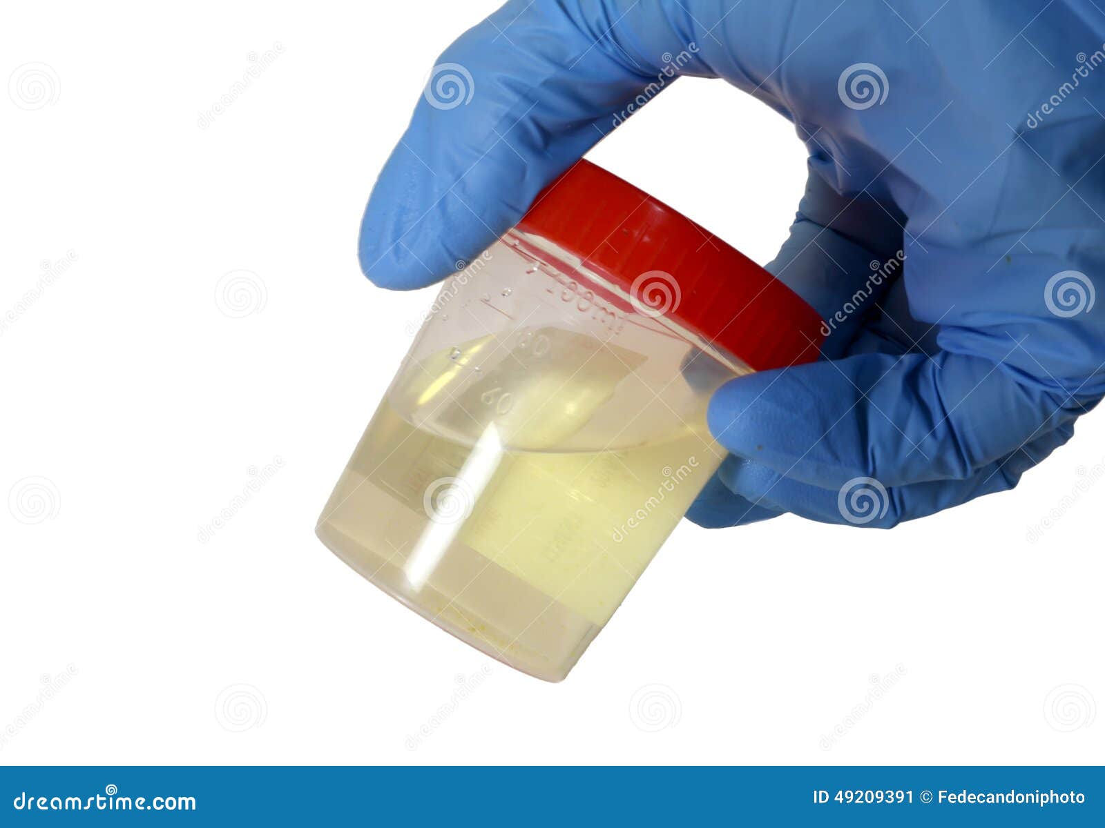 container for urinalysis in the hand of the doctor