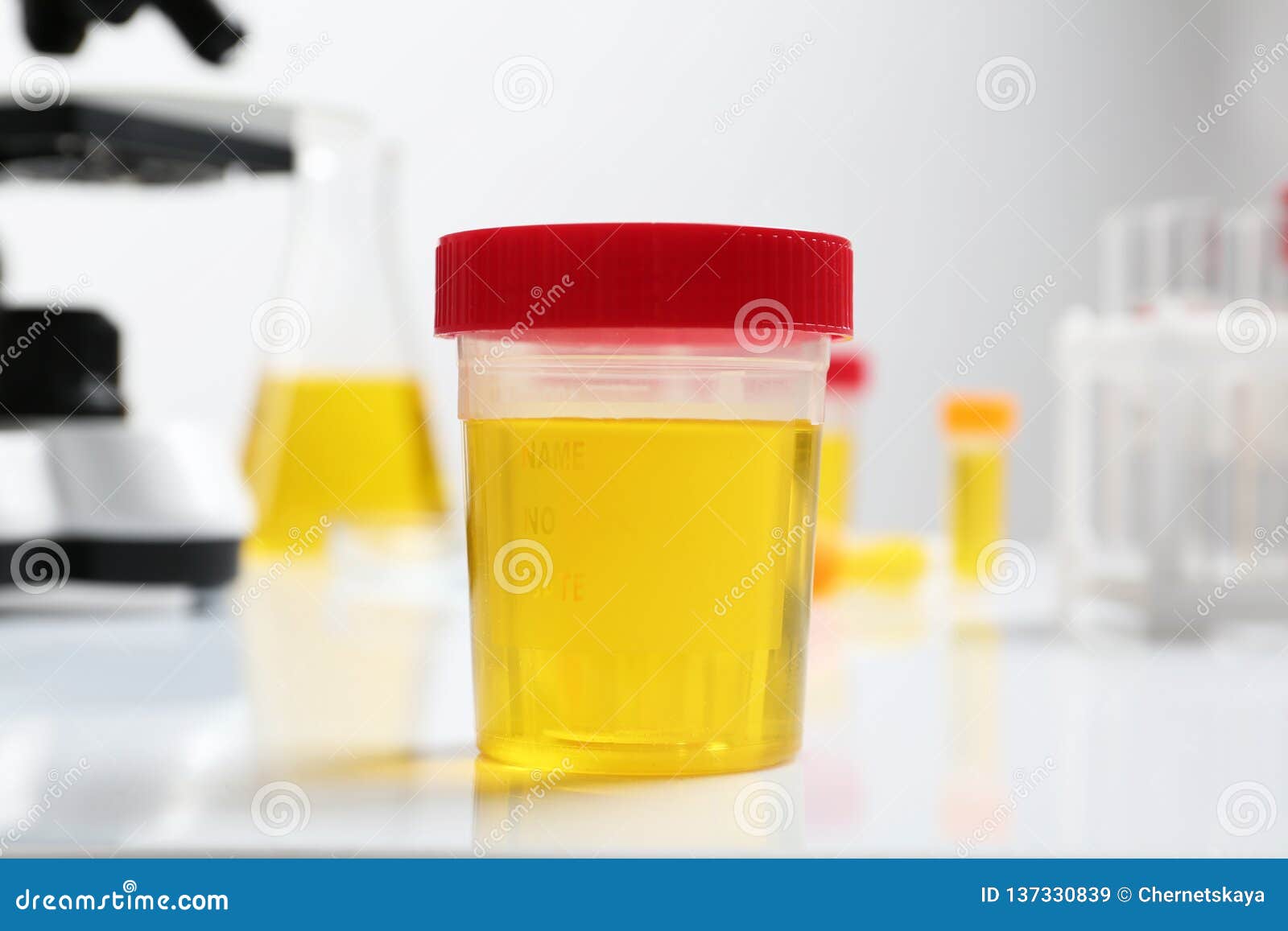 container with urine sample for analysis on table