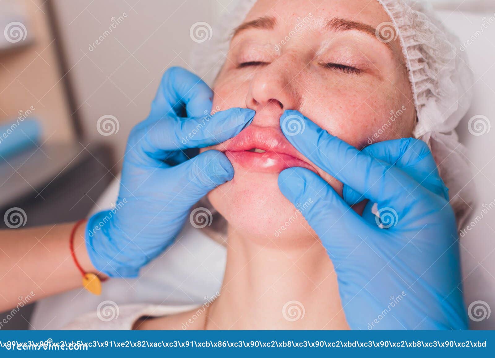 Contour Plastic Lip Massage after Injection of Filler. Stock Photo